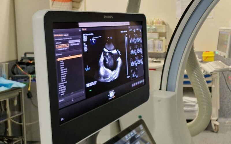 El HUCA realiza la primera intervención del país para la reparación simultánea transcatéter de las válvulas cardíacas tricúspide y mitral