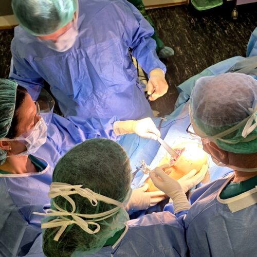 El Hospital de Cabueñes implanta por primera vez en Asturias una prótesis de rodilla con cirugía robótica