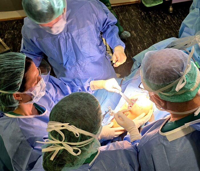 El Hospital de Cabueñes implanta por primera vez en Asturias una prótesis de rodilla con cirugía robótica