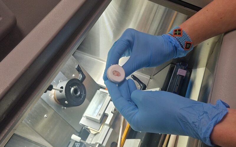 El Hospital Vital Álvarez Buylla consolida la cirugía de Mohs entre sus servicios